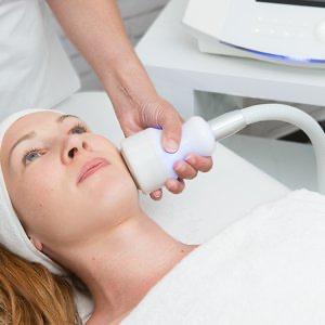 cryo facial treatment